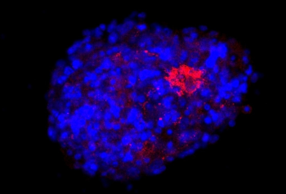 Neuroesfera obtida a partir de células tronco neurais de camundongos e infectada com o vírus SARS CoV 2 adaptado