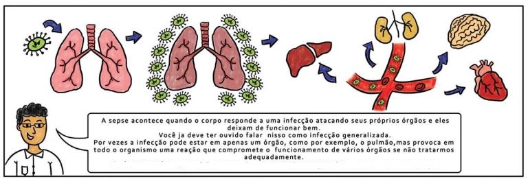 Sepse: conhecida antigamente como septicemia ou infecção no sangue, a sepse, hoje também chamada de infecção generalizada, é um conjunto de manifestações graves em todo o organismo produzidas por uma infecção; Por vezes, a infecção pode estar localizada em apenas um órgão, mas provoca em todo o organismo uma resposta com inflamação em uma tentativa de combater o agente da infecção; Pode comprometer o funcionamento de vários órgãos. Por isso, o risco de vida. Esse quadro é conhecido como disfunção ou falência de múltiplos órgãos. 