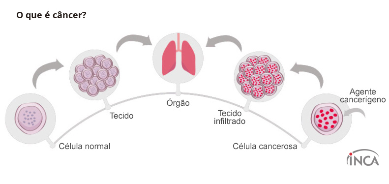 o que e cancer celulas 1