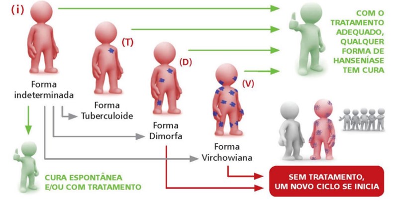 Hanseníase – Domum